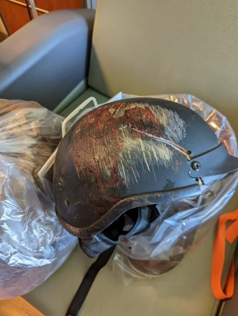How Often Should You Replace a Helmet?