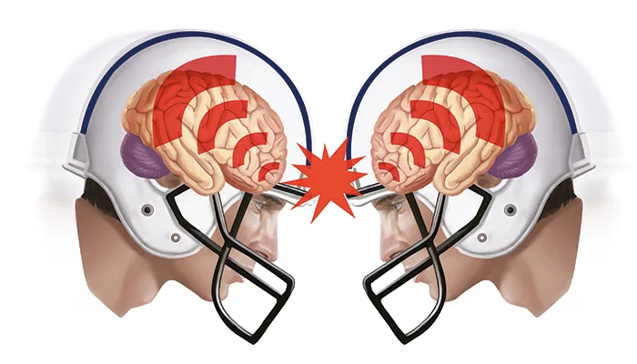 Head Injuries and Brain Trauma